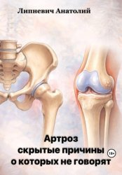 Скачать Артроз: скрытые причины, о которых не говорят бесплатно