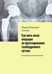 Скачать Как жить после операции по протезированию тазобедренного сустава. Руководство для пациентов бесплатно