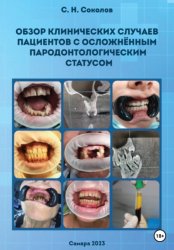 Скачать Обзор клинических случаев пациентов с осложнённым пародонтологическим статусом бесплатно